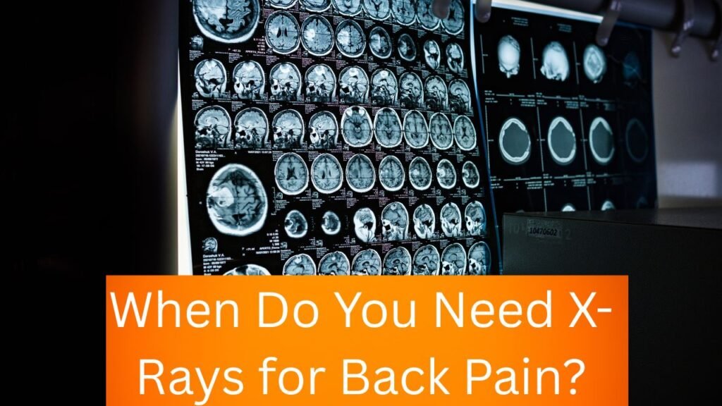 When Do You Need X-Rays for Back Pain?