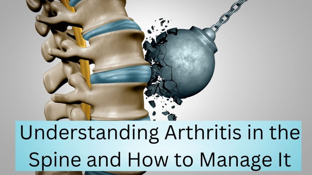 Understanding Arthritis in the Spine and How to Manage It